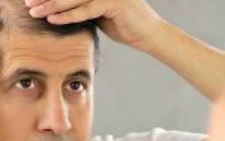 Сезонное выпадение волос: когда и почему это может происходить?