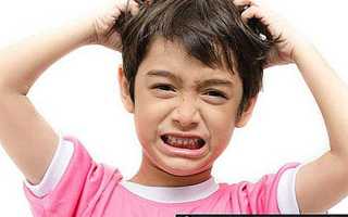 Перхоть у ребенка: причины и лечение
